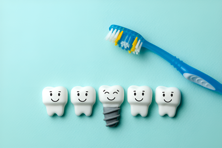 Implants dentaires - L'entretien quotidien essentiel